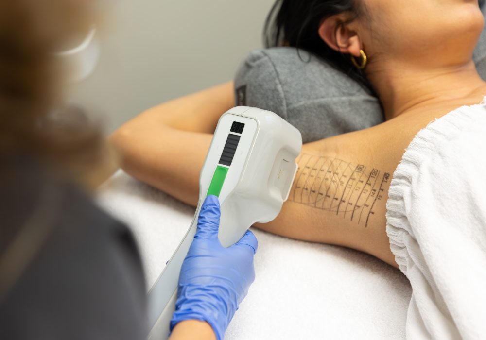 A-Beautiful-You-MiraDry-2126